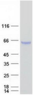 Coomassie blue staining of purified AFP protein.